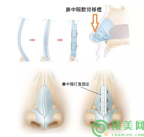 秦皇岛市鼻中隔矫正手术医院排名榜前十强榜实力机构评选-秦皇岛琪媛整形医疗美容诊所口碑top人气汇总