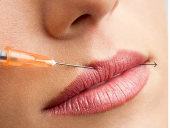 玻尿酸丰唇可以改善哪些问题？