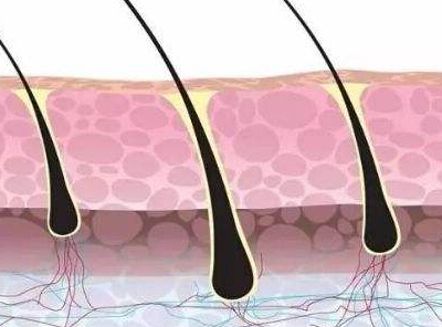 怎样让头发毛囊再生