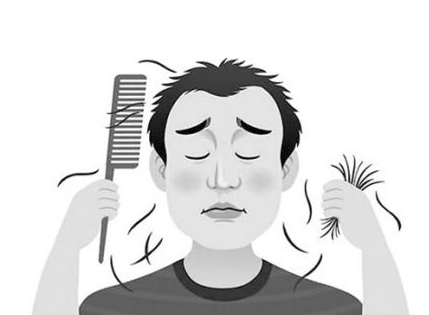 脂溢性脱发是怎么治疗的呢