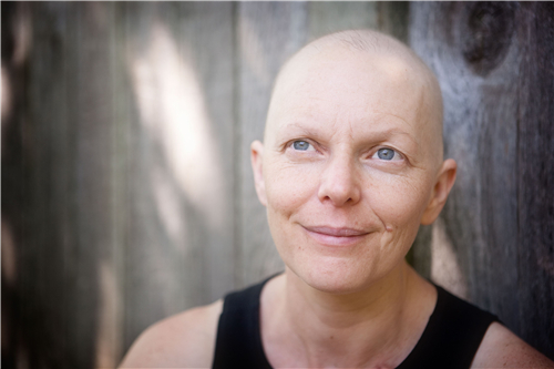 乳腺癌患者为什么会脱发