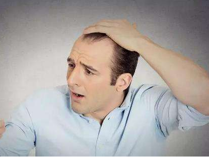 中年男性应该如何正确的预防脱发