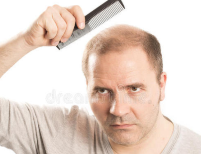 中年男性应该如何正确的预防脱发