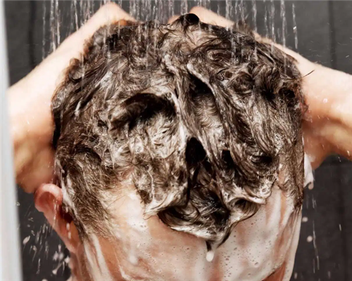 四种方式预防男性脱发