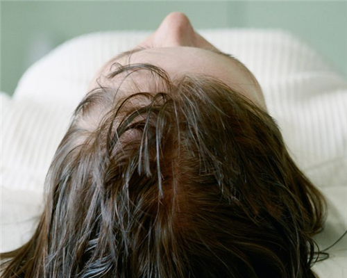 湿着头发睡觉对头发的影响