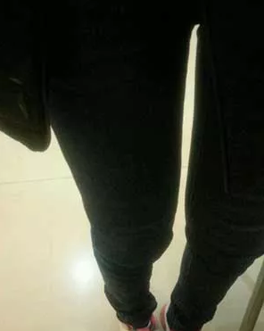 吸脂瘦大腿