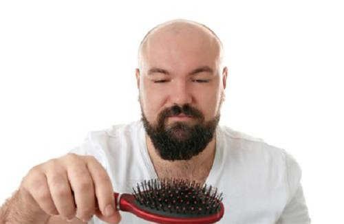 针对男性*常见的几种脱发类型该怎么治疗？