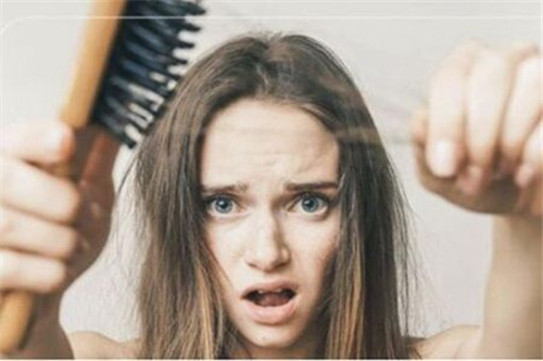 女性脂溢性脱发的症状有哪些？