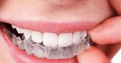 牙齿矫正