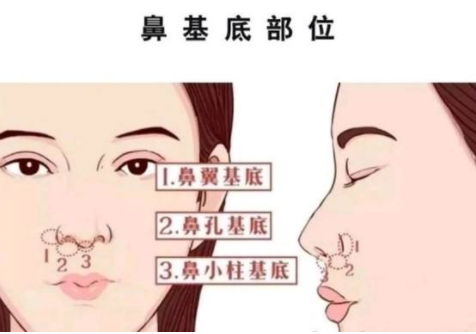 鼻基底位置