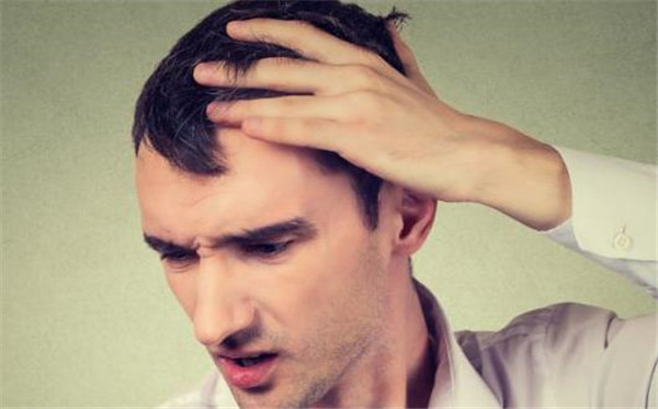 治疗男性脱发的重点是什么？