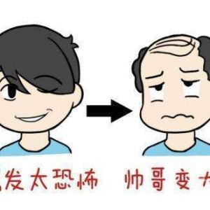 湖南长沙有什么好的植发医院推荐吗？