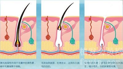 毛囊成活率不代表利用率