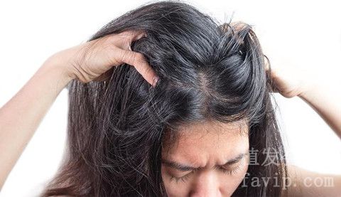 女性脂溢性脱发是什么原因引起的？