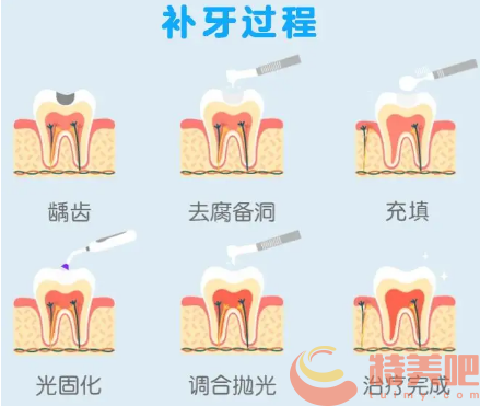 补牙