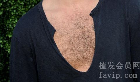 上海种植胸毛要多少钱？