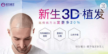 新生3D植发技术多少钱？