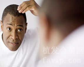 重庆哪些医院做无痕植发较好？得多少钱？