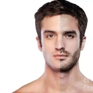 种植胡子后遗症有哪些？