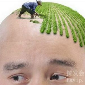 广州种植头发需要多少钱？