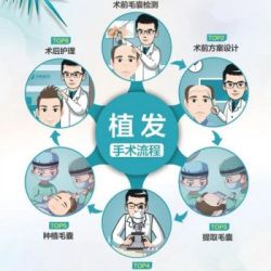 云南曲靖麥穗植發(fā)