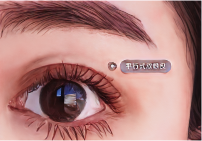 哪些情况属于双眼皮失败需要做修复?