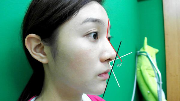 怎样才算是完美的面部鼻梁?面部轮廓这样做才更好看。