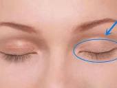 双眼皮手术比双眼皮贴好在哪里呢？