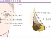 韩式隆鼻不同于传统隆鼻之处有哪些？