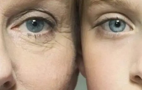 眼周的衰老该怎么解决呢？