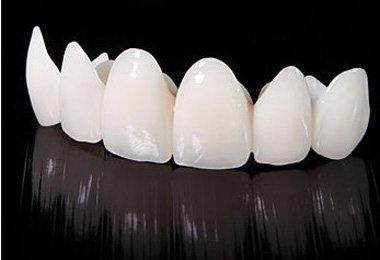 二氧化锆牙齿价格多少钱？对比全瓷牙有哪些区别？