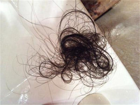 脱发头发分叉毛躁是什么原因？