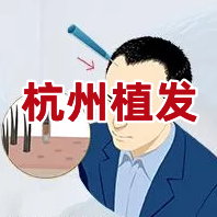 杭州植发医院排名前三的是哪几家?
