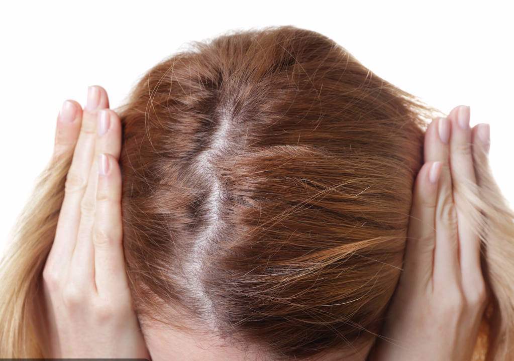 神经性脱发原因以及治疗方法有哪些