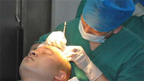 植发手术对身体有什么危害