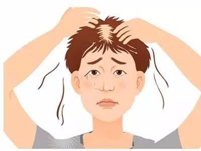 什么是脱发，导致脱发的原因是什么呢？