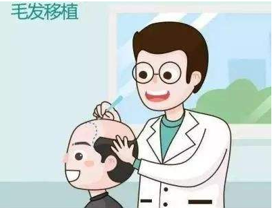 广州比较好的植发医院如何选择