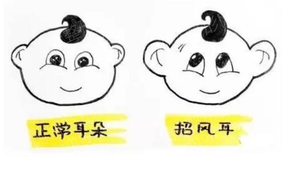 北京市*好的耳部整形医生排名 于晓波