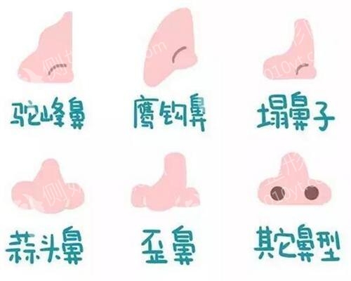广州隆鼻医生排名