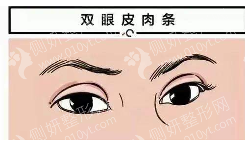 北京八大处双眼皮专家